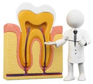 What is a root canal?