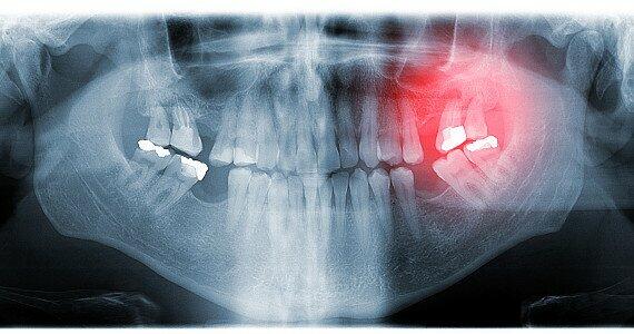 Periodontics