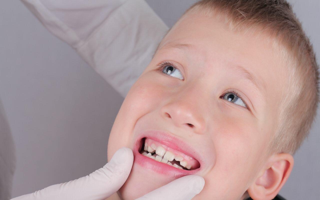 when-should-kids-get-braces