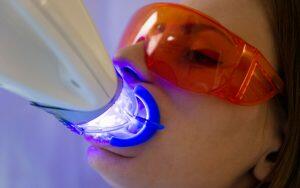 professional-teeth-whitening-Bradford-Family-Dentistry