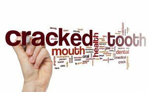 cracked-tooth-pain-symptoms-Bradford-Dentist