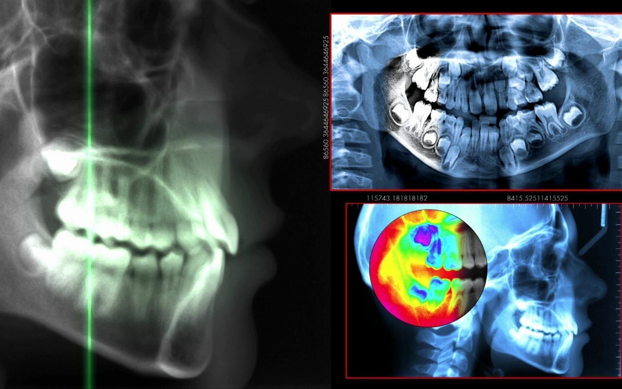 improved-diagnostics-in-modern-dentistry-Bradford-Family-Dentistry