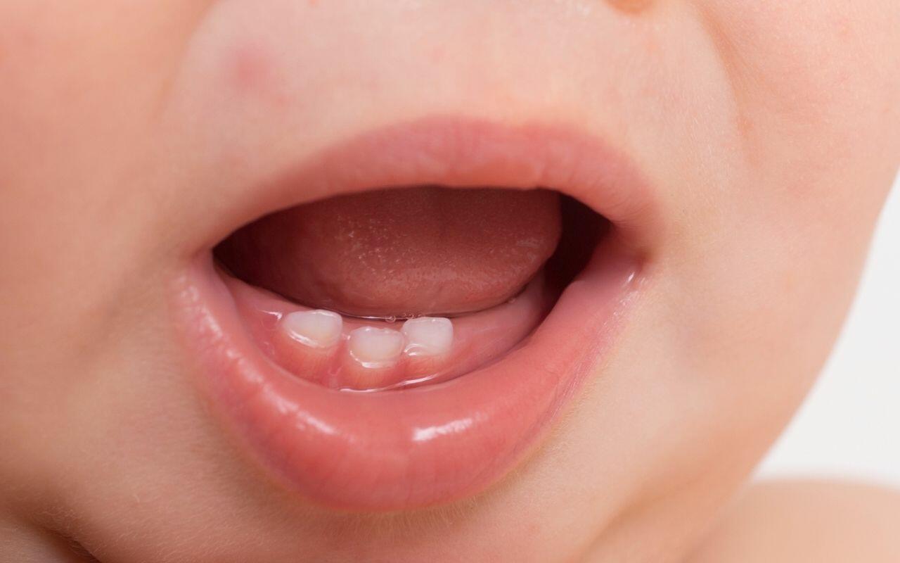 when-should-baby-receive-dental-care-Bradford-Family-Dentistry