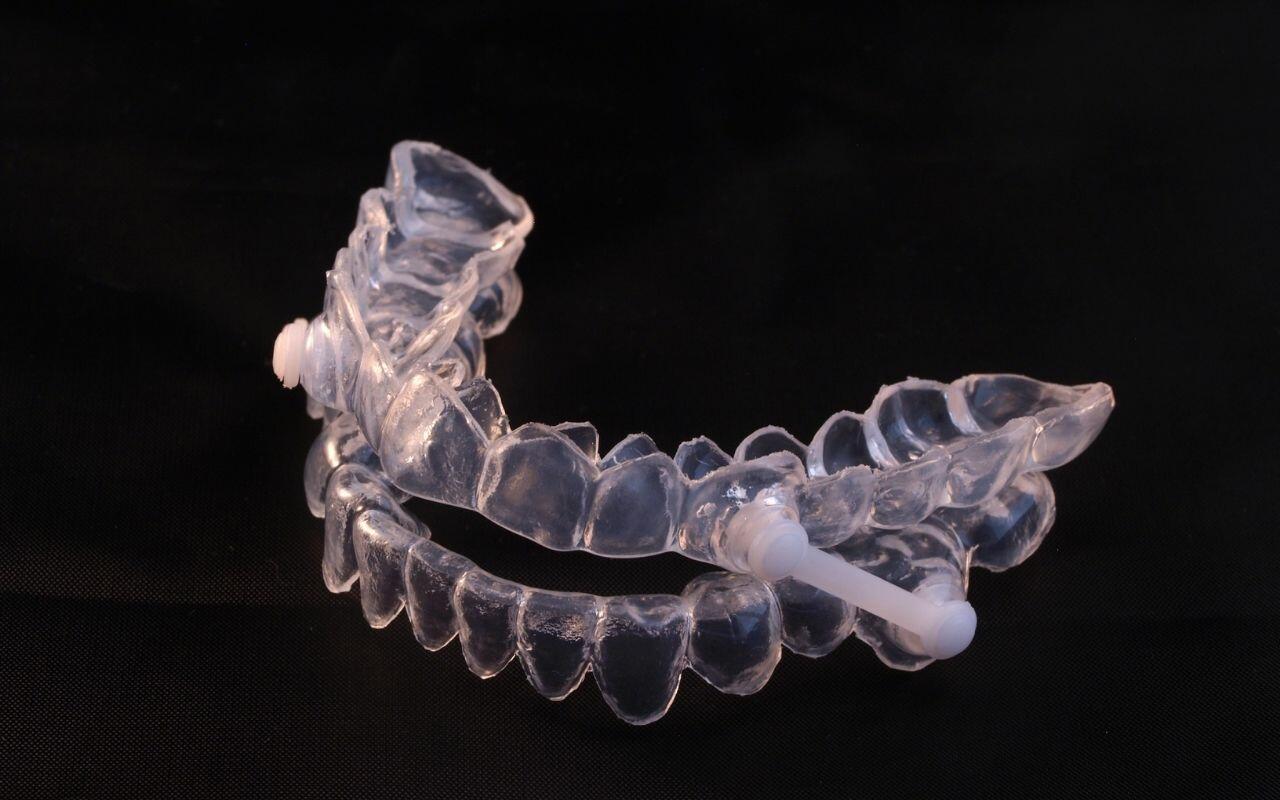 how-does-dentist-help-with-sleep-apnea-dental-appliance