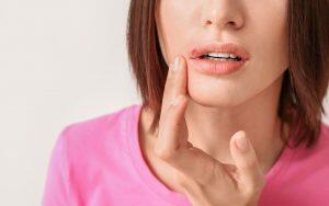 how-long-do-cold-sores-last-Bradford-Family-Dentistry