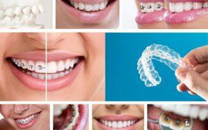 A collage of photos showcasing various types of braces available in Bradford and their associated costs.