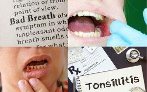 signs-of-poor-oral-microbiome-health-Bradford-Family-Dentistry