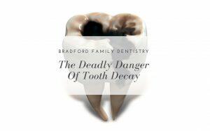 the-deadly-danger-of-tooth-decay-Bradford-Family-Dentistry