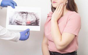 A woman explores the safety of keeping her impacted wisdom teeth by examining a dental x-ray.