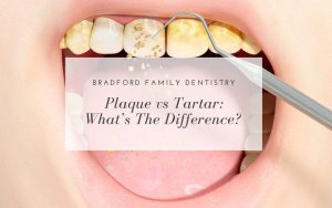 Plaque vs tartar what's the difference?