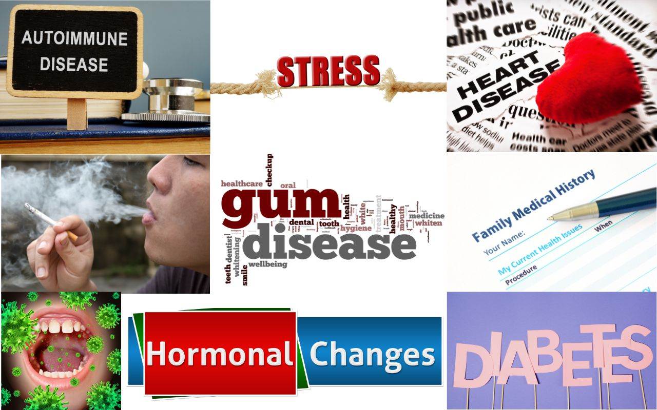 causes-and-risk-factors-of-gum-disease-can-you-have-gum-disease-and-not-even-know-it