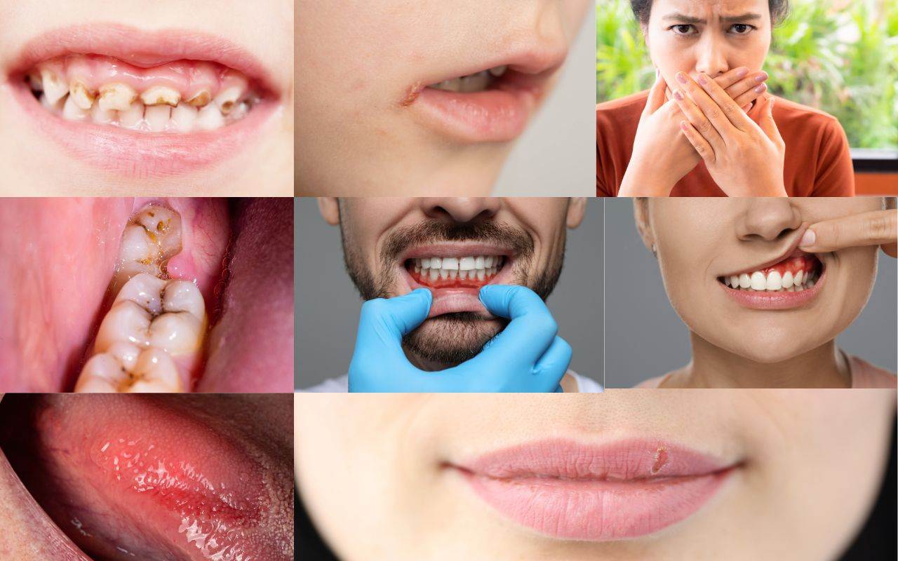 symptoms-of-vitamin-deficiency-in-oral-health