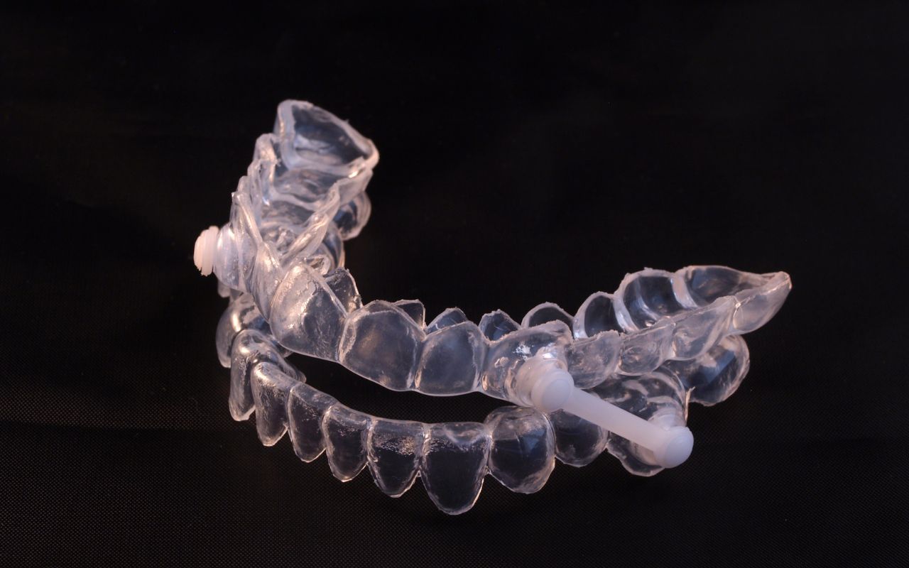 A clear plastic mandibular advancement device on a black background, used for treating sleep apnea.