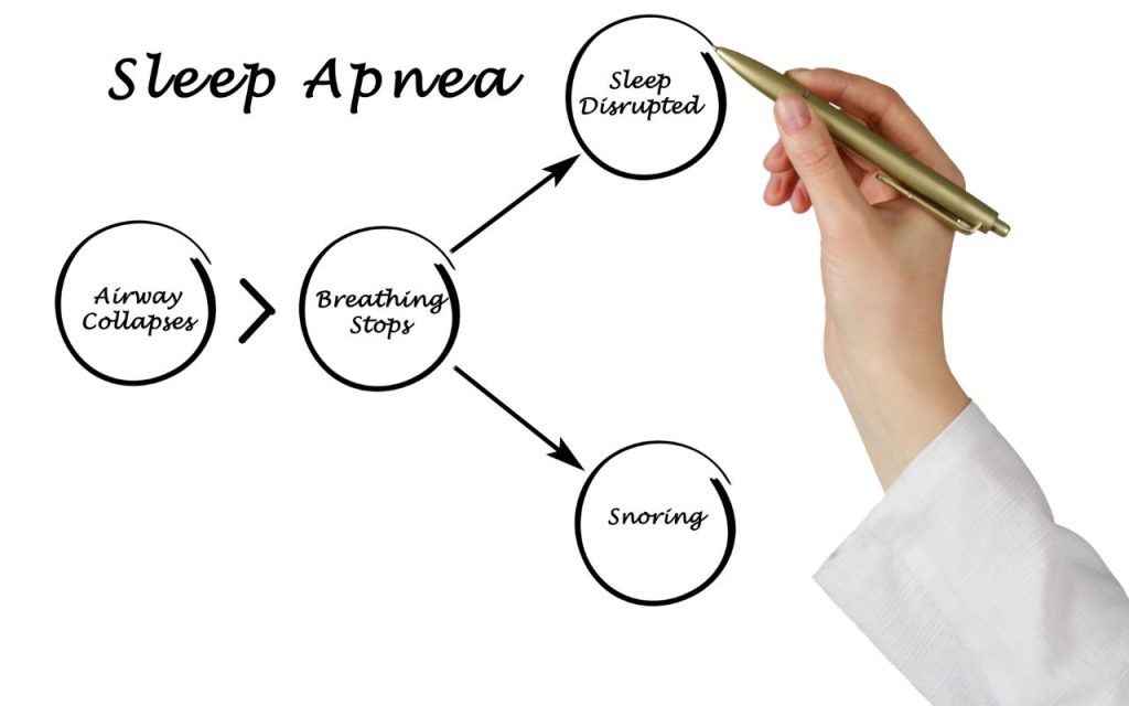 Sleep Apnea Explanation And Treatment - Bradford Family Dentistry