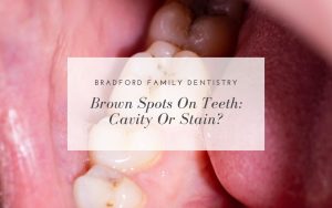 Close-up view of molar teeth with visible brown spots, accompanied by a text overlay that reads, "Bradford Family Dentistry: Brown Spots On Teeth - Cavity Or Stain?.