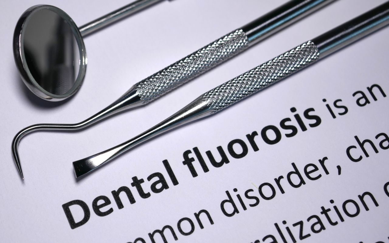 common-causes-of-brown-spots-on-teeth-dental-fluorosis