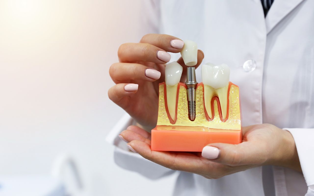 A person in a white coat holds a dental implant model showing teeth, gums, and jawbone structure.